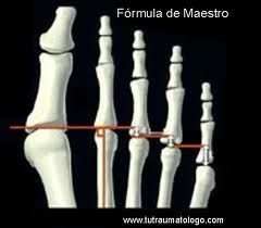 Braqimetatarsia (Formula)